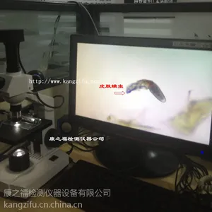 供应中国检螨仪|螨虫检测仪|广州检螨仪|螨虫观察仪,测螨仪
