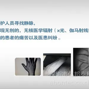 供应静脉血管显像仪诚征全国合作商