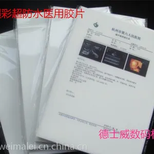 厂家直销环保瓷白喷墨高清防水彩超优质医用胶片A3