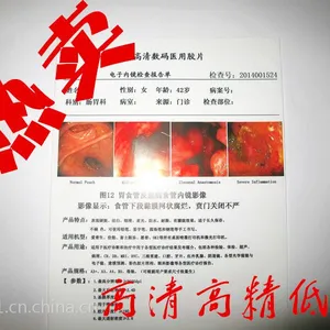 供应半透磨砂双面打印PET医用喷墨激光打印胶片B超四维彩超胃肠镜