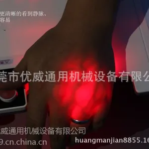 供应供应静脉毛血管显示仪毛血管显影仪价格批发