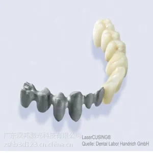 汉邦牙科金属3D打印应用