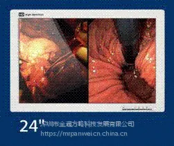 FSN24寸医疗监视器FS-L2403D 厂家直销