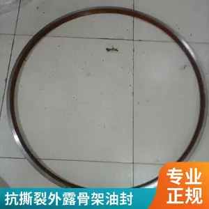����ӹ���¶����Ǽ��ͷ��ܷ�� �����´�ֱ�����ֹ��