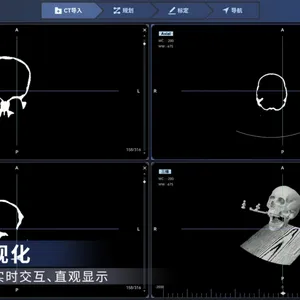 协作机器人+近红外光学追踪仪+控制软件开源平台