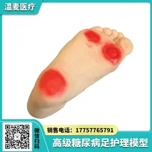 温麦医疗 ******足护理模型 足部病理变化 病变***教学 医学模具