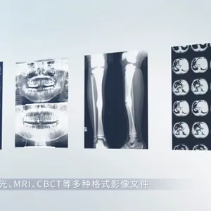 协作机器人+近红外光学追踪仪+控制软件开源平台