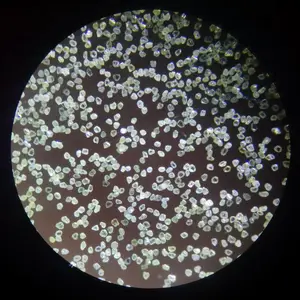 ������ʯ MBD�� ������ 6-12�Դ� ���ʯ΢��