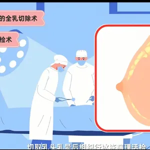 MG动画制作手绘MG动画制作二维动画制作