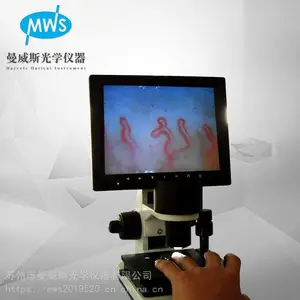 厂家高清微循环观测仪MWS-XW880 专业检测甲壁血流亚健康检测仪