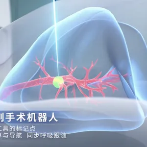 艾目易aimooe粒子植入 胸腹部穿刺活检 手术导航手术机器人开发平台