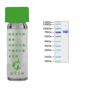 Recombinant Mouse EphB2 Protein 重组蛋白 鼠源