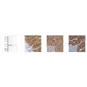 Abcam Anti-beta Actin���� ab8227 �ڲο��� 100ul ��Ʒ�ֻ�