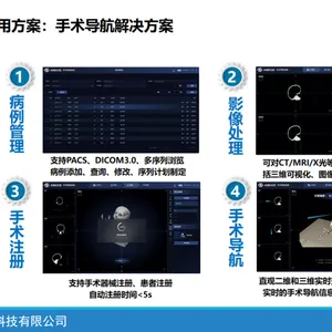 医疗科技进取之选：完善医学图像处理的功能模块与SDK接口助力手术规划项目