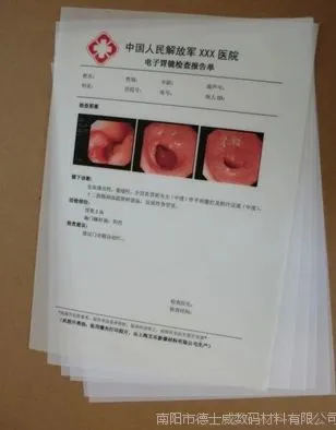 供应优质激光双面医用胶片A3