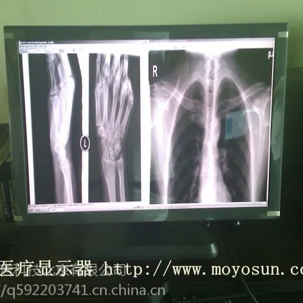 4M医用显示器 台湾MDC(4M)医用显示器