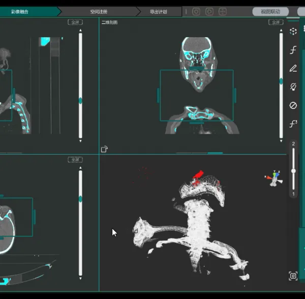 ��ͼMedical ARi�����廯�����п���Ƽ���ά����