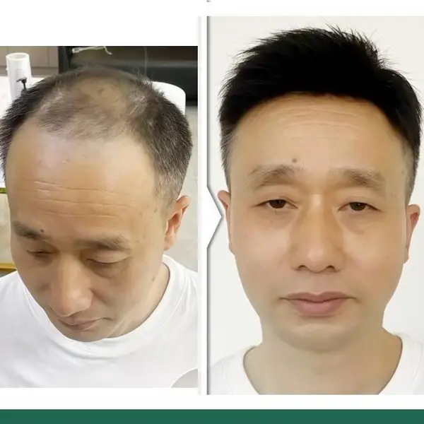 北京真发假发套店朝阳区推荐