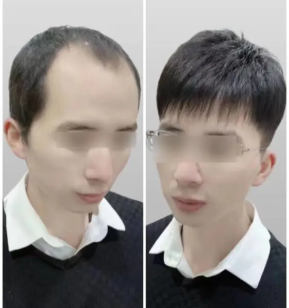 淅川县女士假发千丝美***定制|发型时尚|欢迎光临